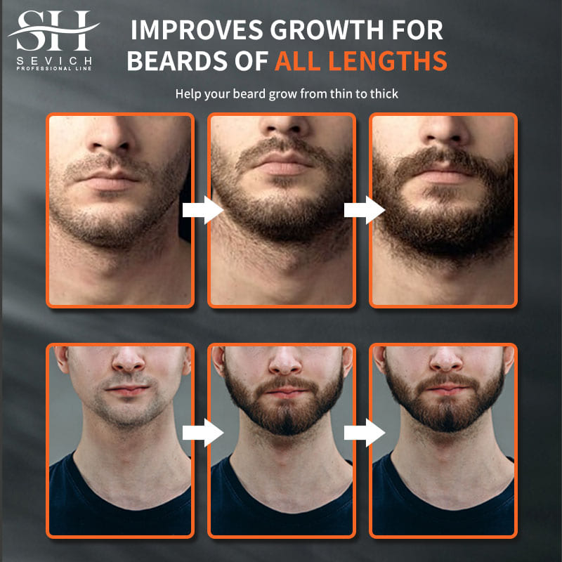Sevich Men Beard Growth Essent - Hair Care Hair Serum recension och pris