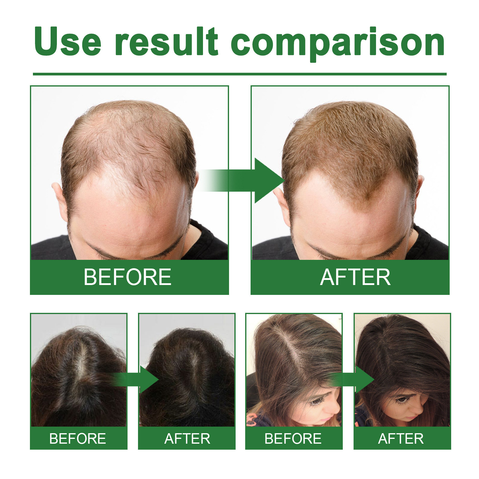 Rosemary Spray for Hair Nouris - Hair Care Natural recension och pris